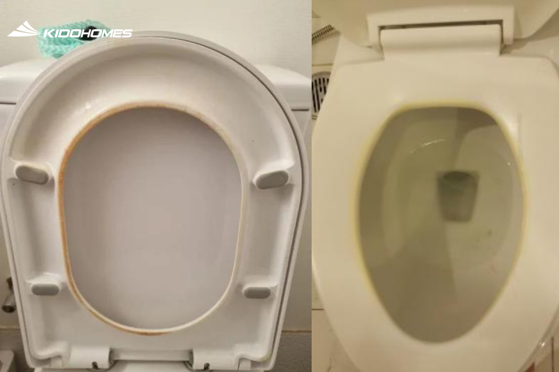 Nắp bồn cầu nhựa bị ố vàng do nhiều nguyên nhân